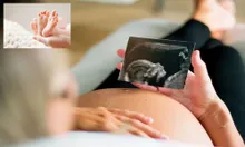 मह‍िला के शरीर में है 2 गर्भाशय, दोनों में थे बच्चे, जानिए हैरान करने वाली सच्चाई
