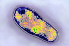 कोविड-19 महामारी के साथ दुर्लभ फंगल बीमारी का अटैक