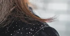 सर्दियों में ड्रैंडफ से छुटकारा पाने के लिए अब घर पर कीजिए ऐसे अपाय, झड़ते बालों से भी मिलेगी निजात
