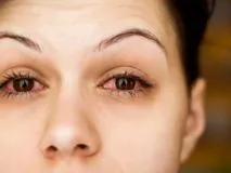 आंखों में दिख रहे ये लक्षण भूलकर भी नहीं करें नजर अंदाज, हो सकता है Omicron
