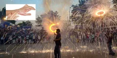 दिवाली में पटाखे चलाते समय जल जाएं तो घबराएं नहीं, फटाफट करें ये घरेलू उपाय