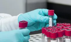 भारतीय स्टार्टअप ने 32 प्रकार के कैंसर का पता लगाने के लिए AI-Based blood test विकसित किया