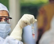 अरुणाचल कोविड-19 के 159 नए मामले, संक्रमितों की संख्या 7 हजार के करीब



