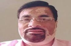असम चुनाव: कांग्रेस ने ECI  से की मांग, हृषिकेश गोस्वामी को CM के मीडिया सलाहकार पद से हटा दें