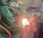 ऑपरेशन टेबल पर हनुमान चालीसा पढ़ती रही लड़की, बिना बेहोश किए दिल्ली एम्स के डॉक्टरों ने कर दी ब्रेन की सर्जरी



