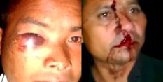 मेघालय: री-भोई जिले में बदमाशों ने दो खासी आदमियों पर बेरहमी से हमला किया